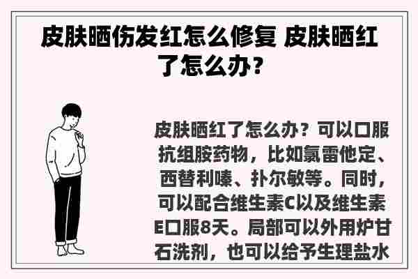 皮肤晒伤发红怎么修复 皮肤晒红了怎么办？